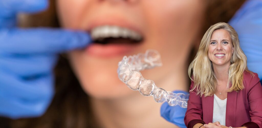Consultoria invisalign en Santander
