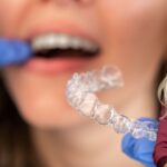 Consultoría Invisalign en Santander
